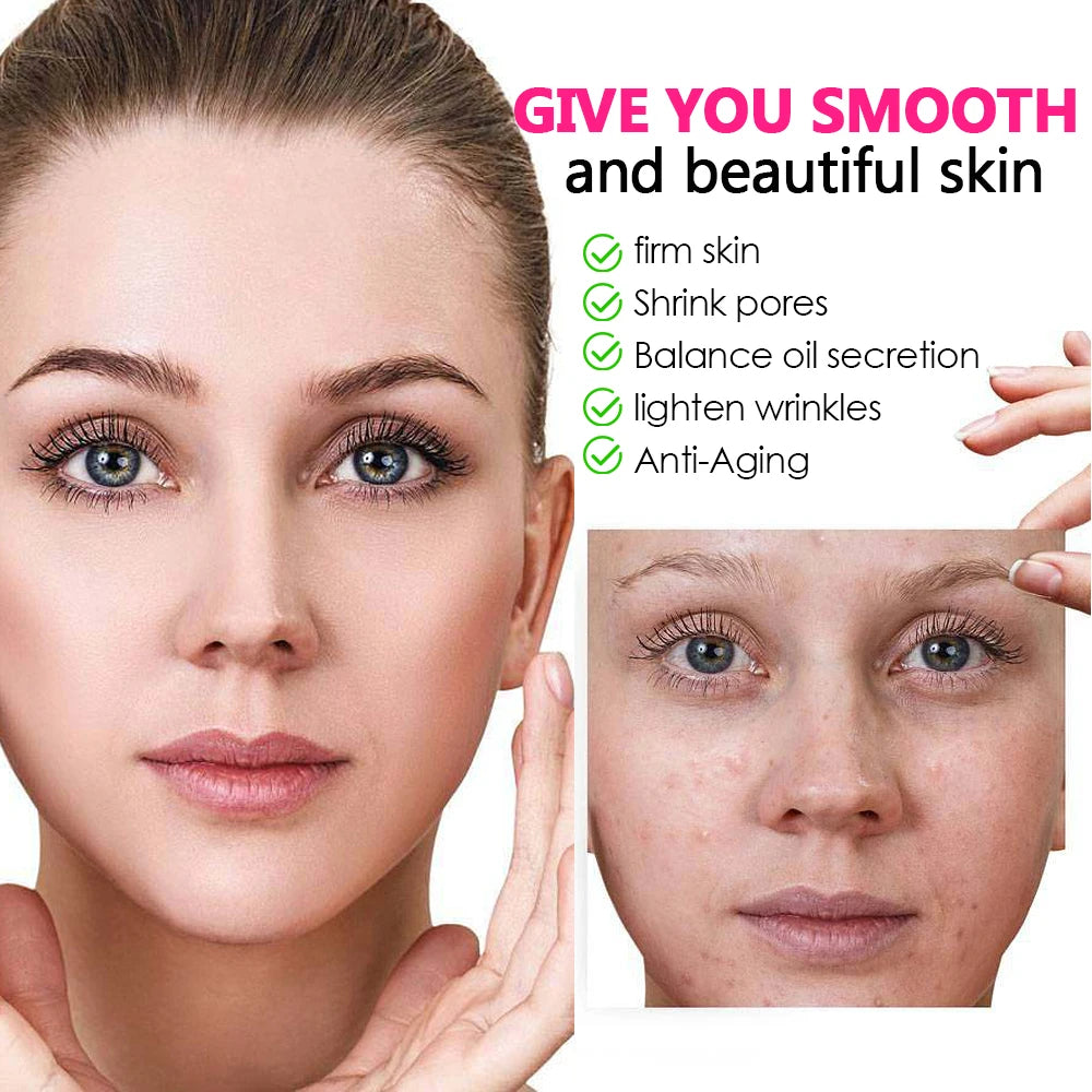 200 LEDs Infrared Light Therapy Lamp Skin Care Anti Aging 660nm 850nm